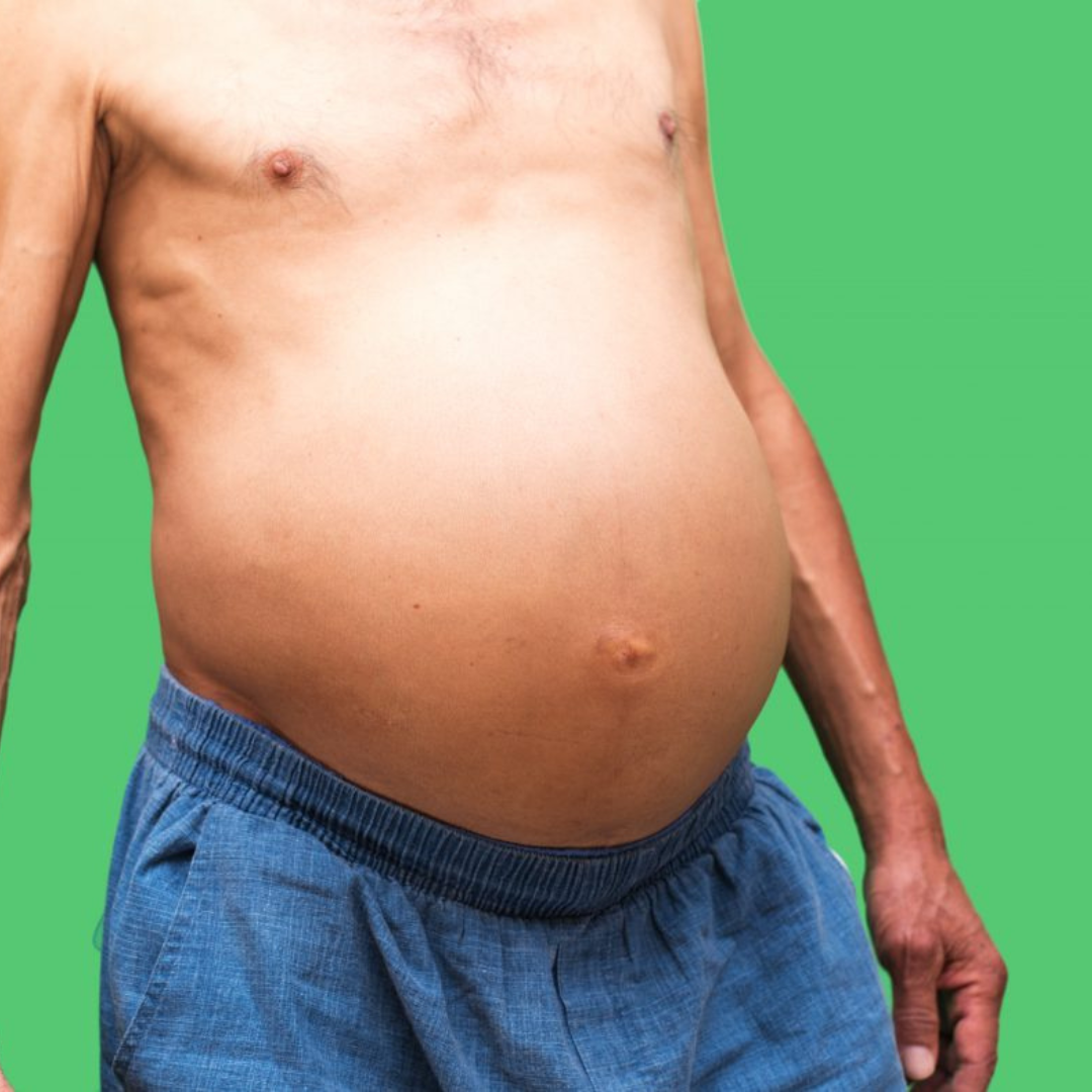 Inchaço e Peso Abdominal