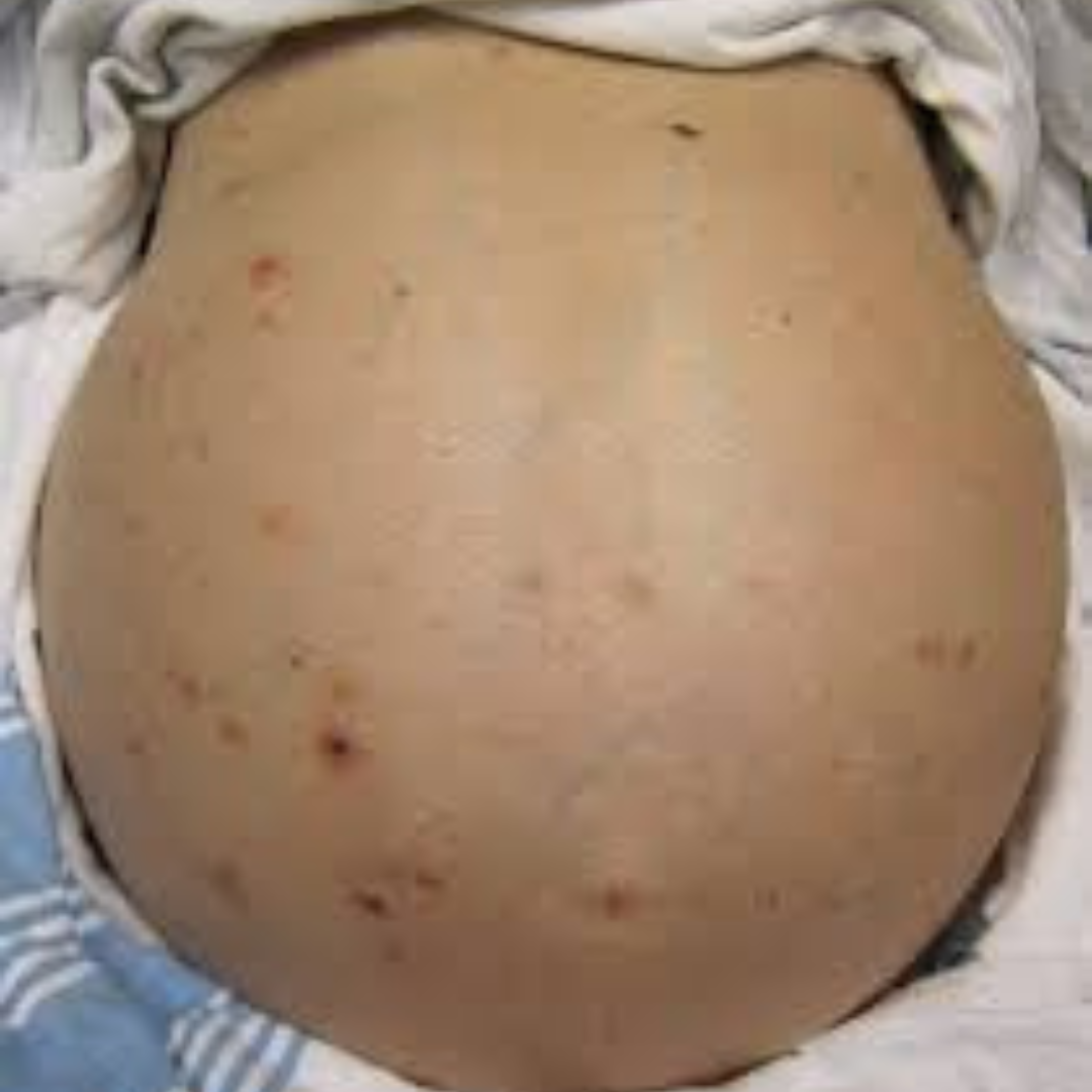 Digestão Lenta e Náuseas